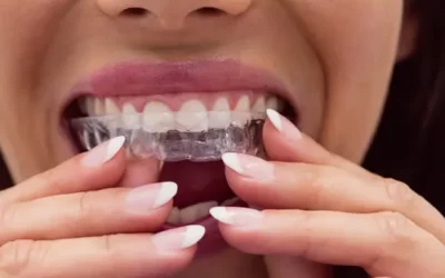 Invisalign Hartford: Clear Aligner Therapy for Discreet Orthodontic Correction